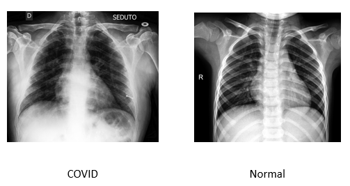 XRay_Classification